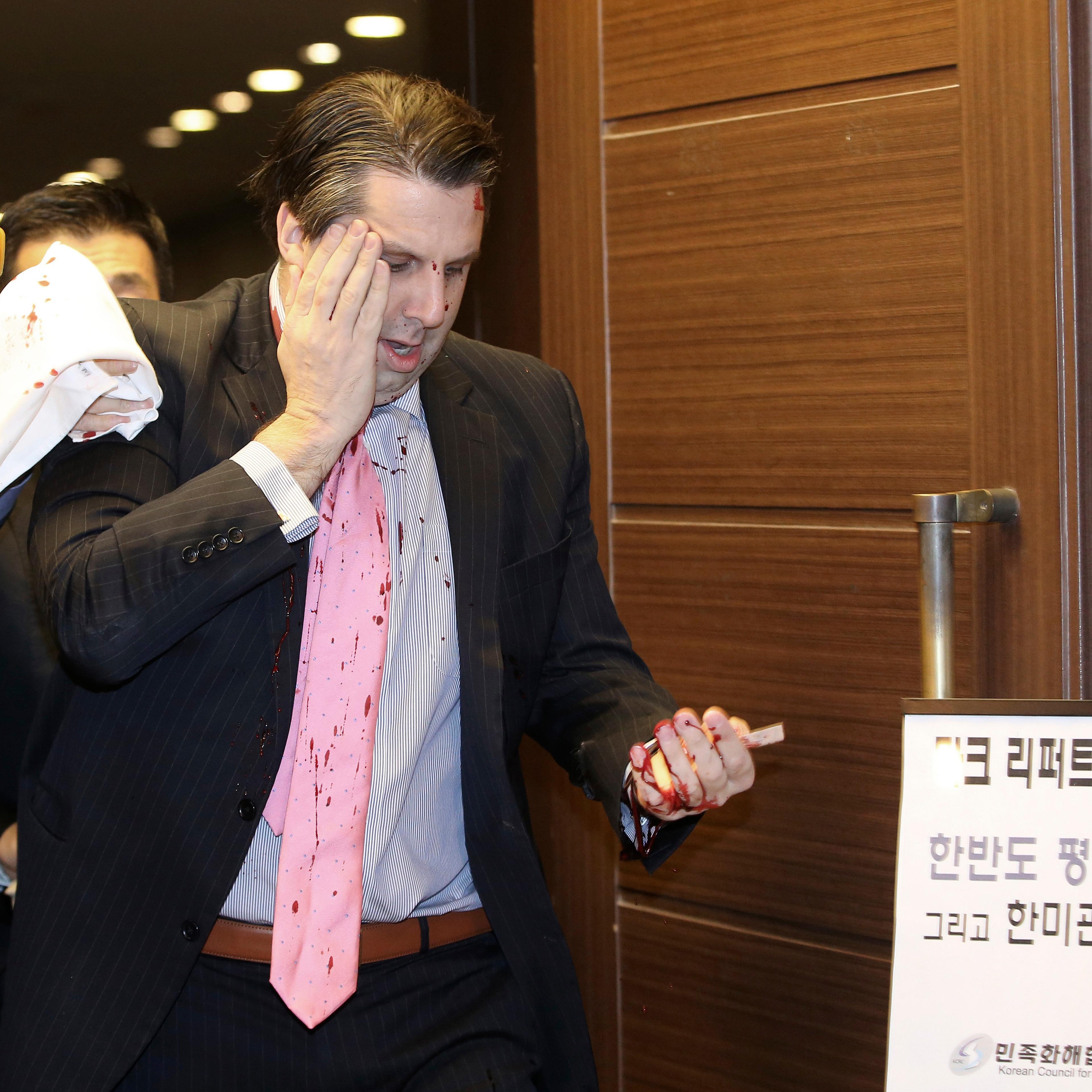 Mark Lippert