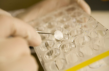 DNA Testing