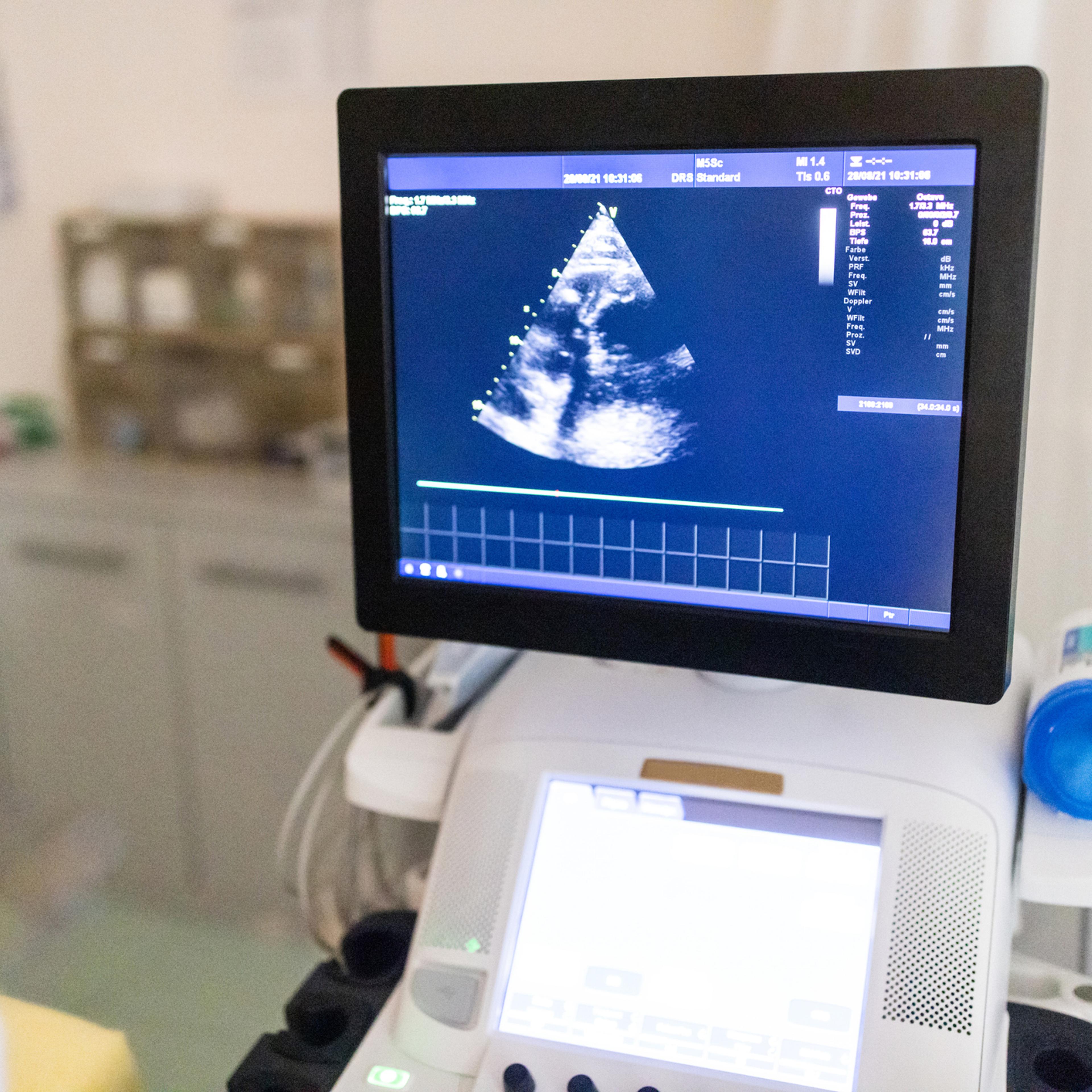 Ultrasound echocardiogram computer monitor in heart clinic