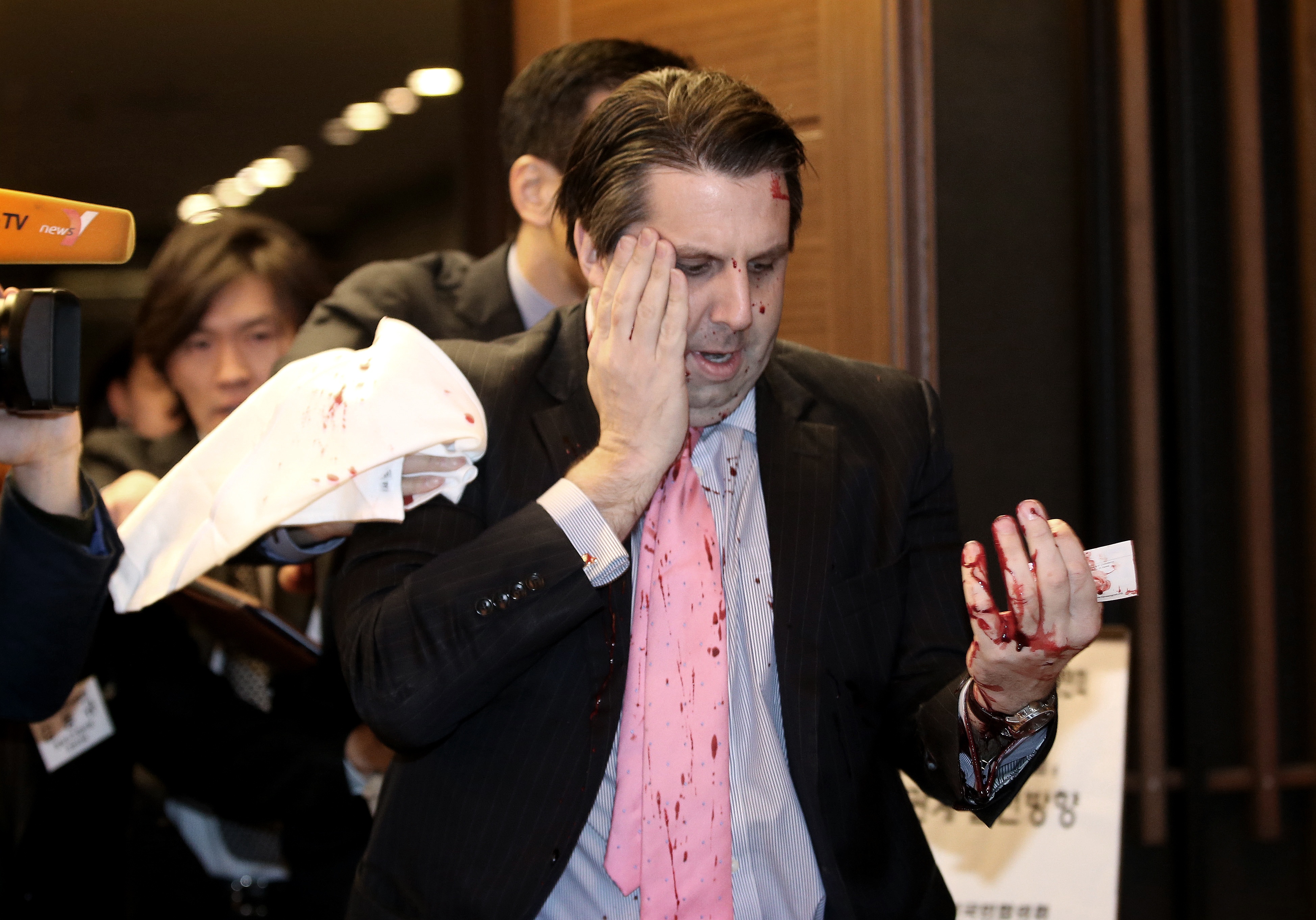 U.S. Ambassador Mark Lippert on March 5, 2015 in Seoul, South Korea