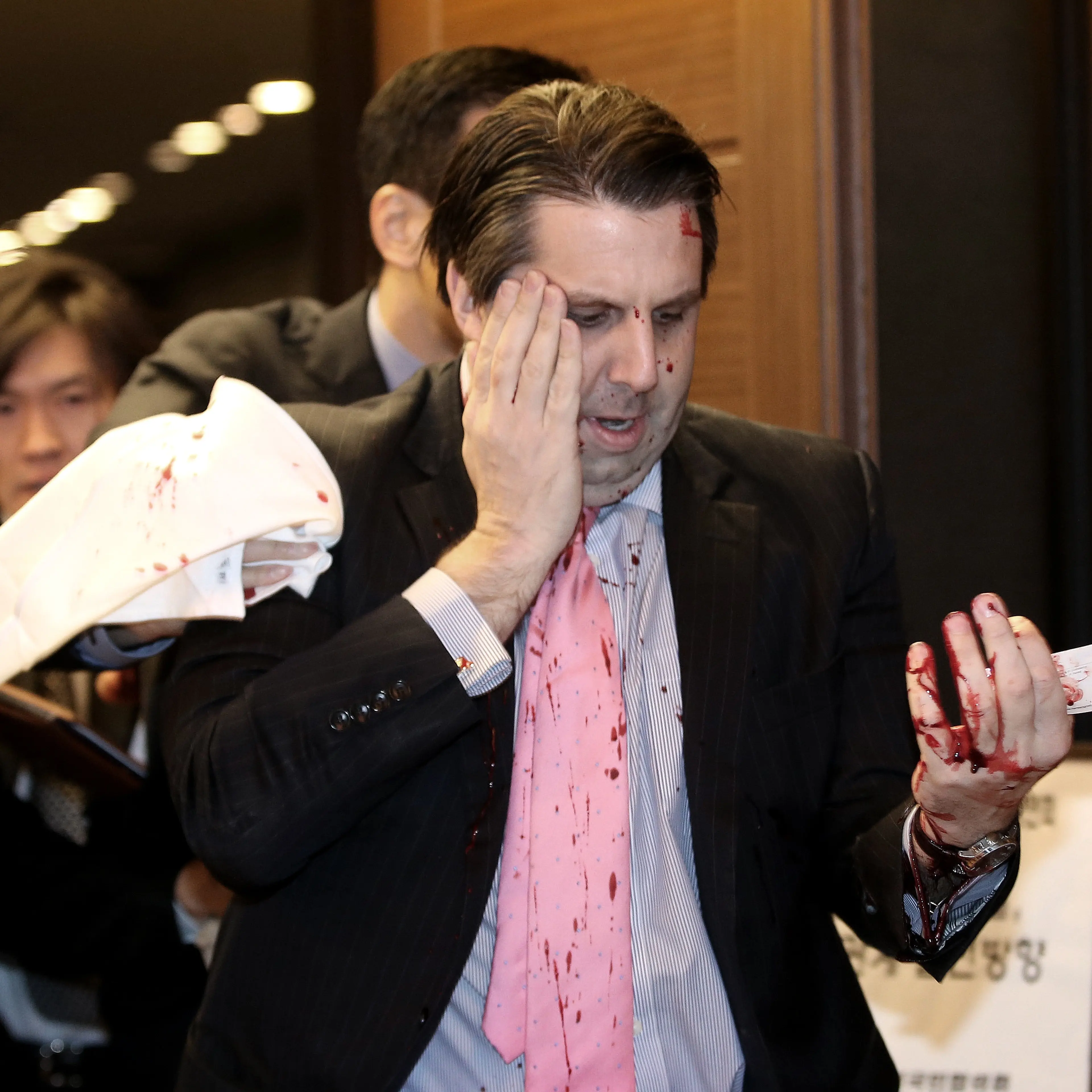 U.S. Ambassador Mark Lippert on March 5, 2015 in Seoul, South Korea