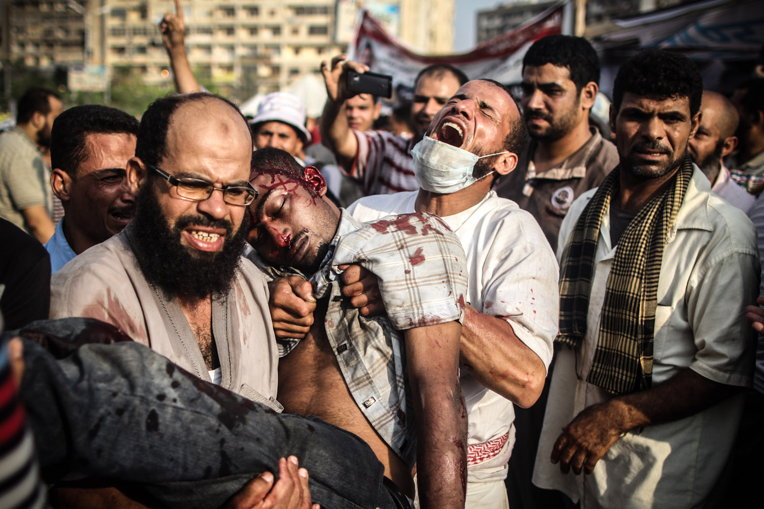 <i>The following photographs were taken on July 27, 2013</i><br /><br />Morsi supporters carry a man shot in the head outside the makeshift hospital in Rabaa Square.