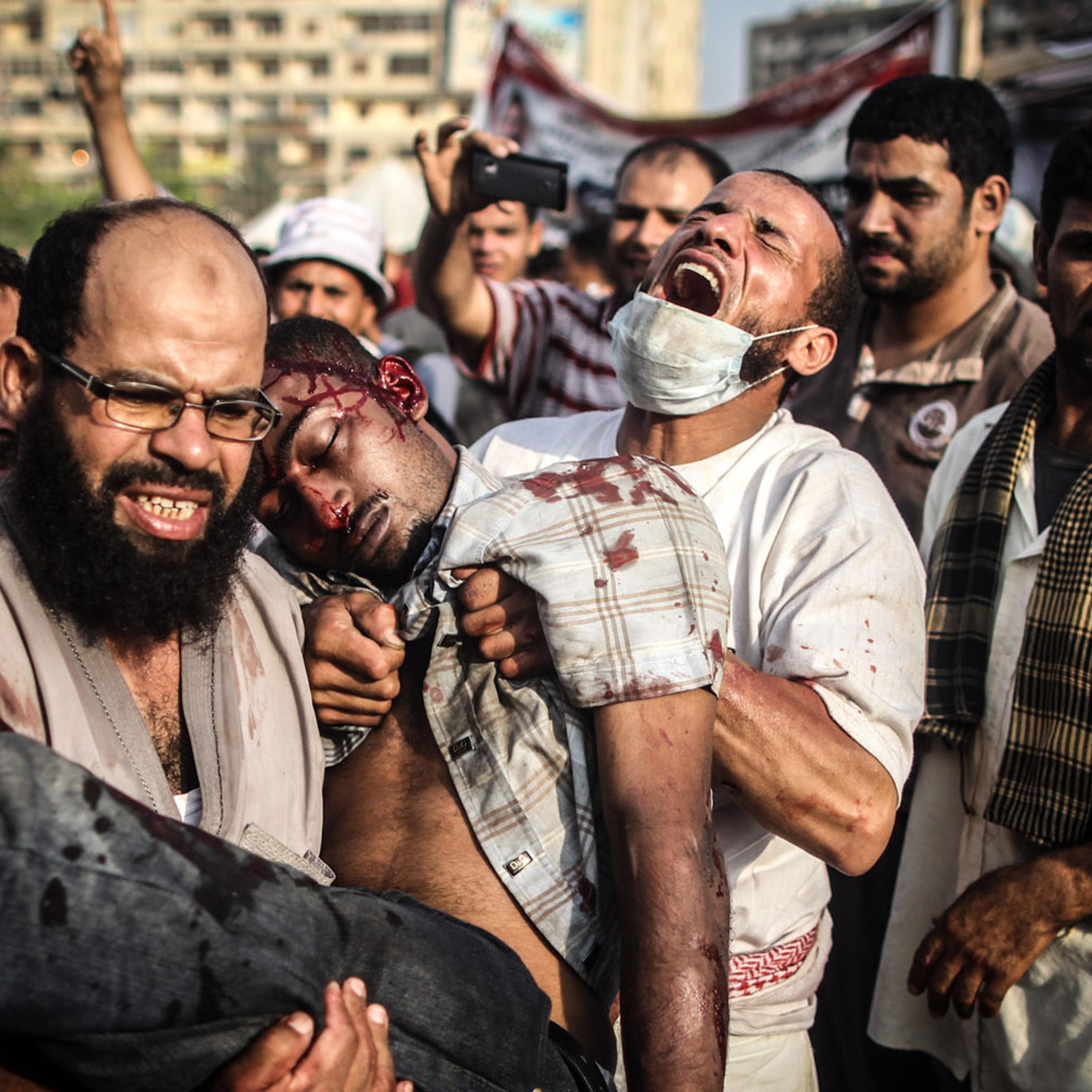 <i>The following photographs were taken on July 27, 2013</i><br /><br />Morsi supporters carry a man shot in the head outside the makeshift hospital in Rabaa Square.