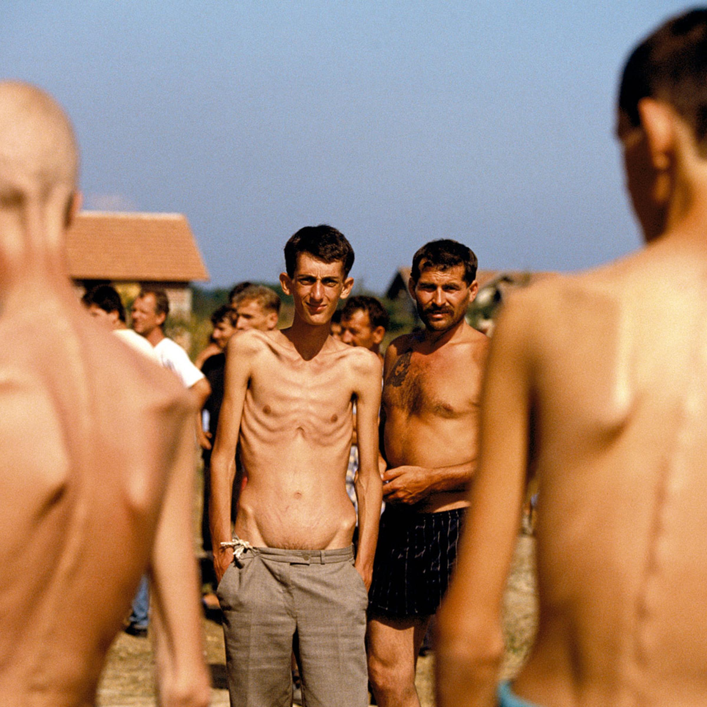 <b>August 1992. Trnopolje.</b><br><br>"When several journalists broke the story of the Serbian prison camps, there was a huge outcry in the world. Immediate comparisons to Nazi concentration camps were invoked and a demand for investigations and intervention were discussed. I was working on the Bosnian Serb side at the time trying to understand the war from their perspective as, like all wars, nothing is completely one-sided. However it was extremely difficult to work as it appeared the Bosnian Serbs didn't understand or care about journalism and the flow of information even when it was to help people understand them.<br><br>I asked a Bosnian Serb Army officer if I could go to a front line near where they had recently lost ground and show the effects on their civilian population. He quickly said no but said if I wanted I could go to visit the prison camps in order to see they really weren't as bad as people thought.<br><br>To this day I am not sure if the Bosnian Serb leadership made