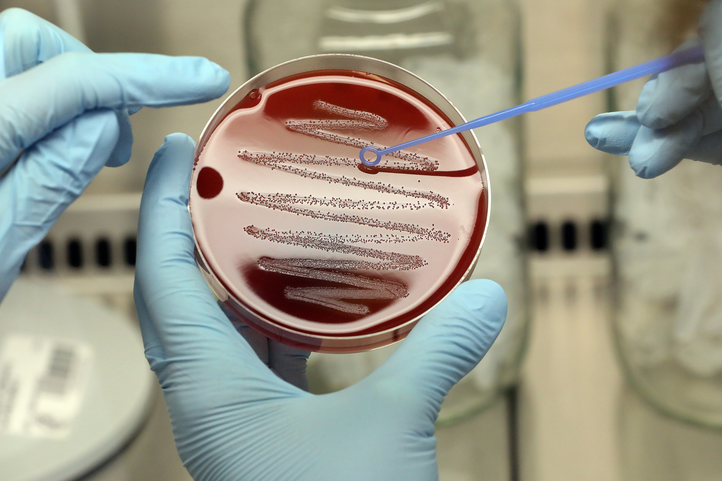CRISPR-Cas9