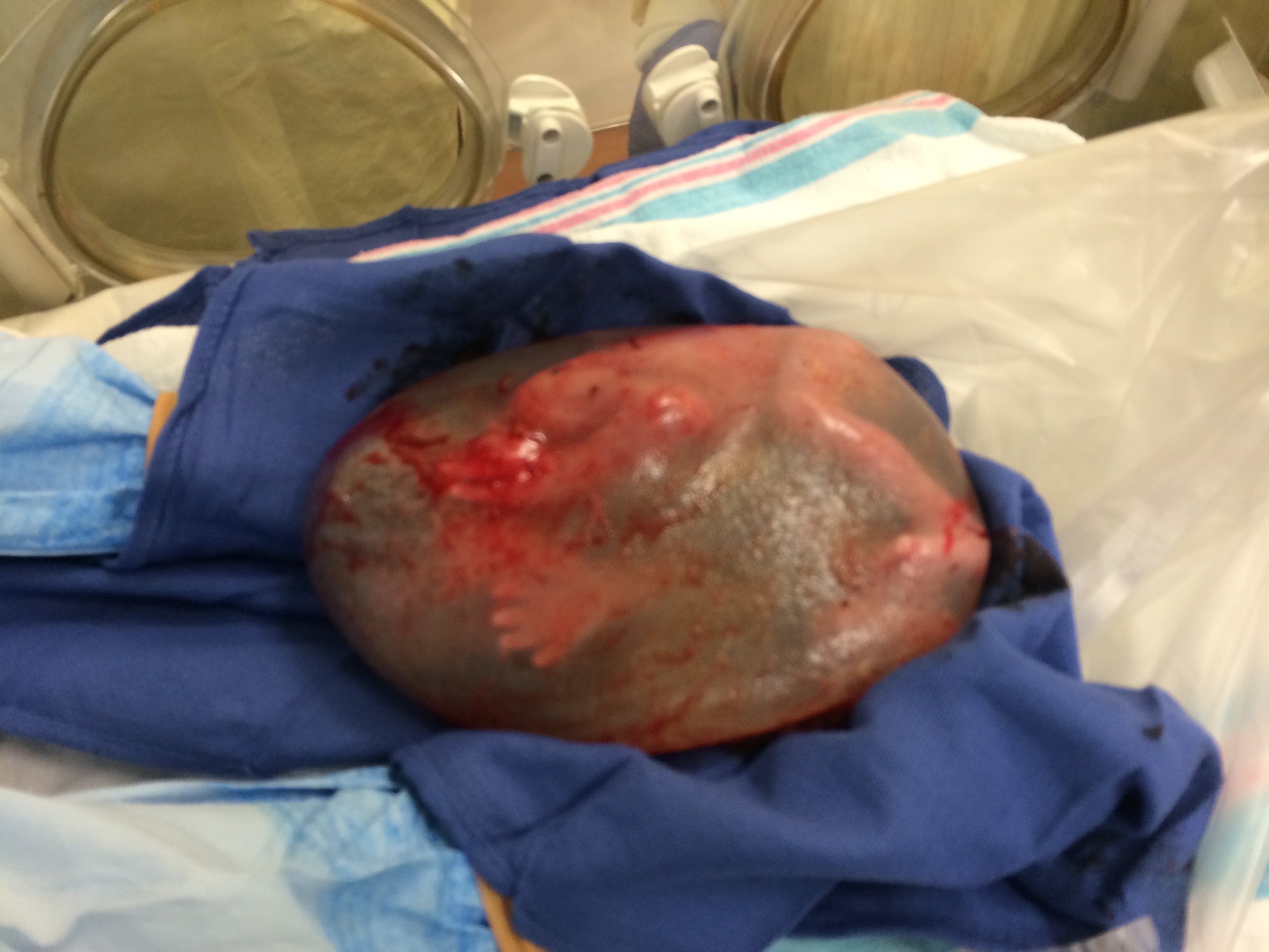 Silas Johnson born still in the amniotic sac at the Neonatal Intensive Care Unit, part of the Maxine Dunitz Children's Health Center at Cedars-Sinai Medical Center on Dec. 6th, 2014 in Los Angeles.