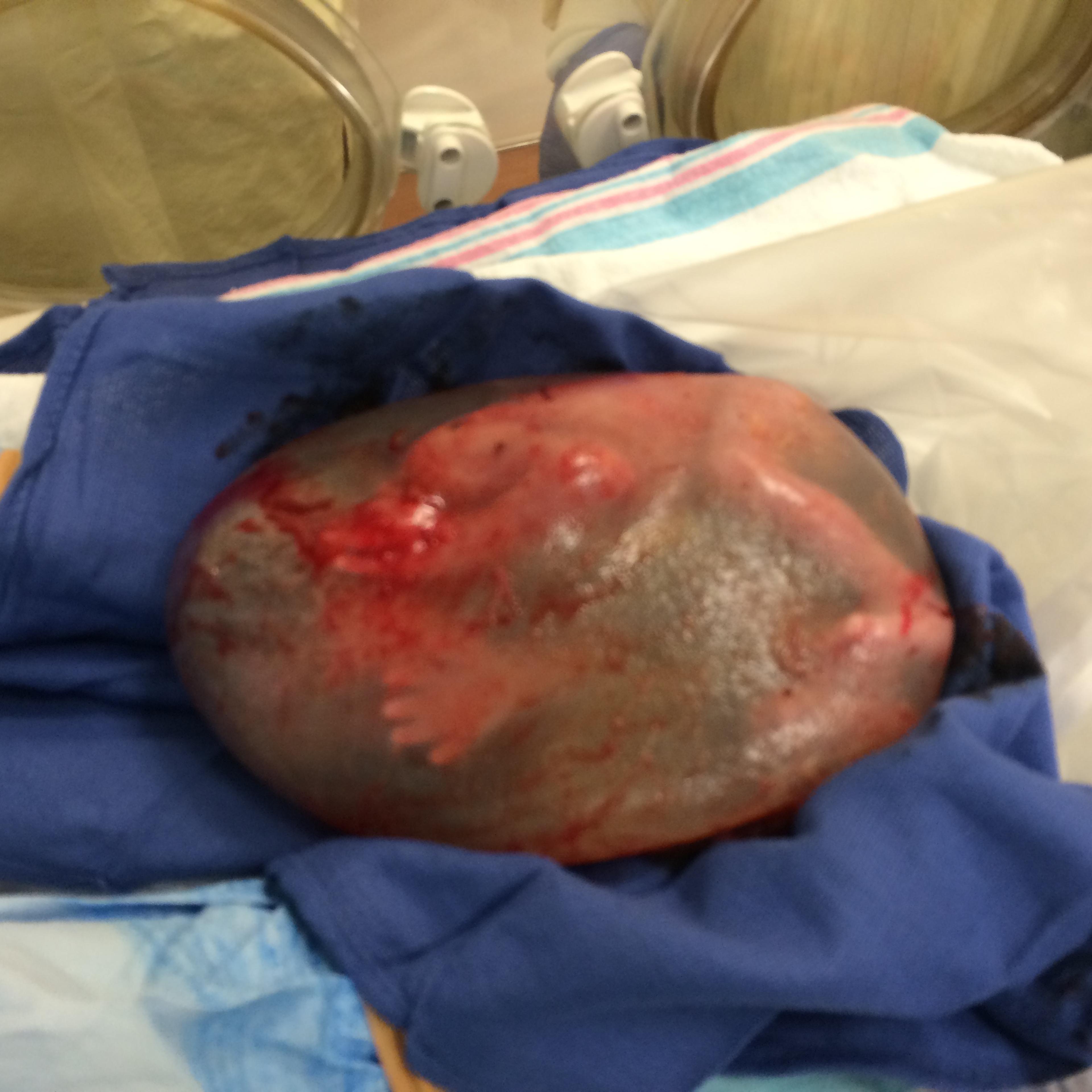 Silas Johnson born still in the amniotic sac at the Neonatal Intensive Care Unit, part of the Maxine Dunitz Children's Health Center at Cedars-Sinai Medical Center on Dec. 6th, 2014 in Los Angeles.