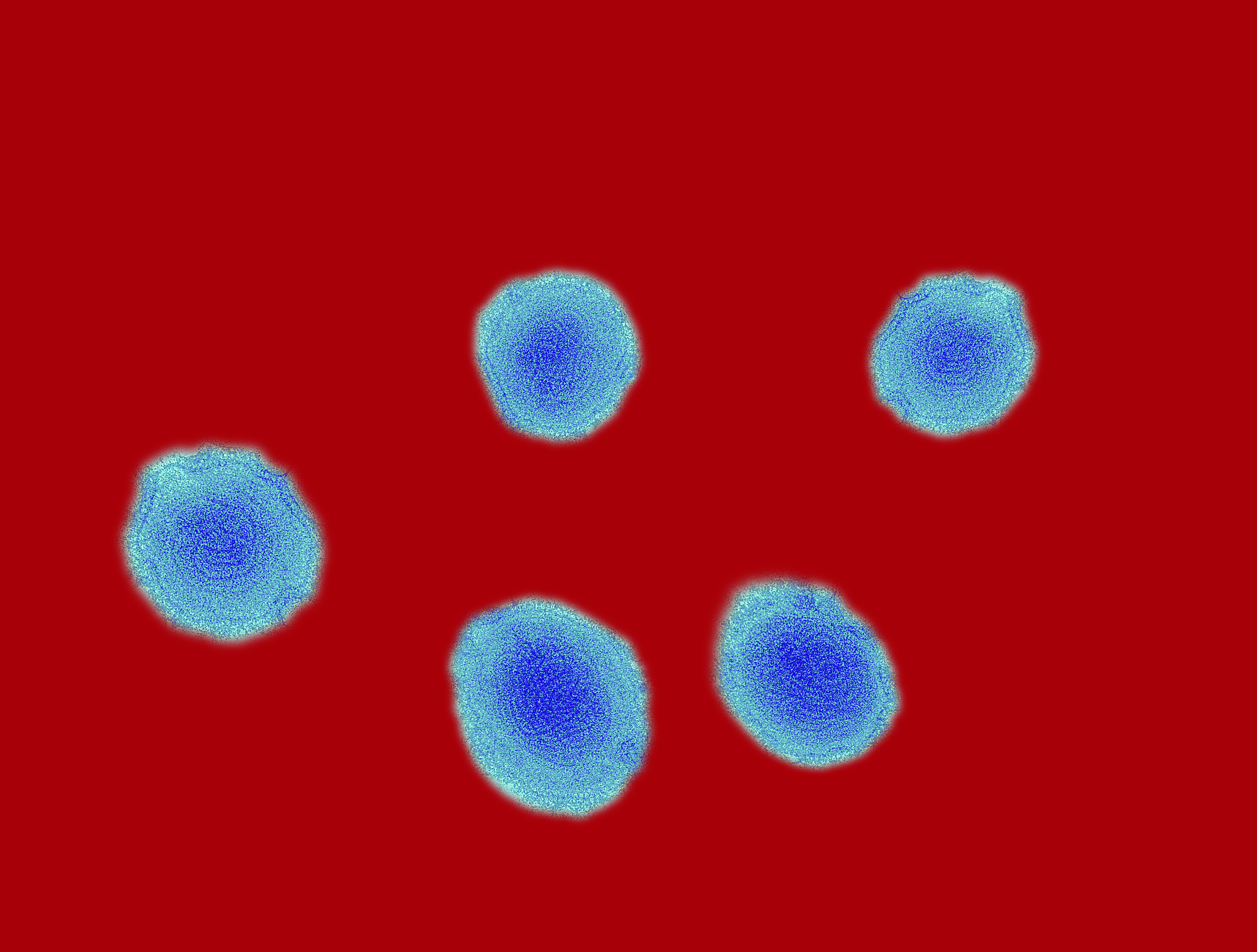 Not your friend: The measles virus—highly magnified—is exceedingly easy to transmit