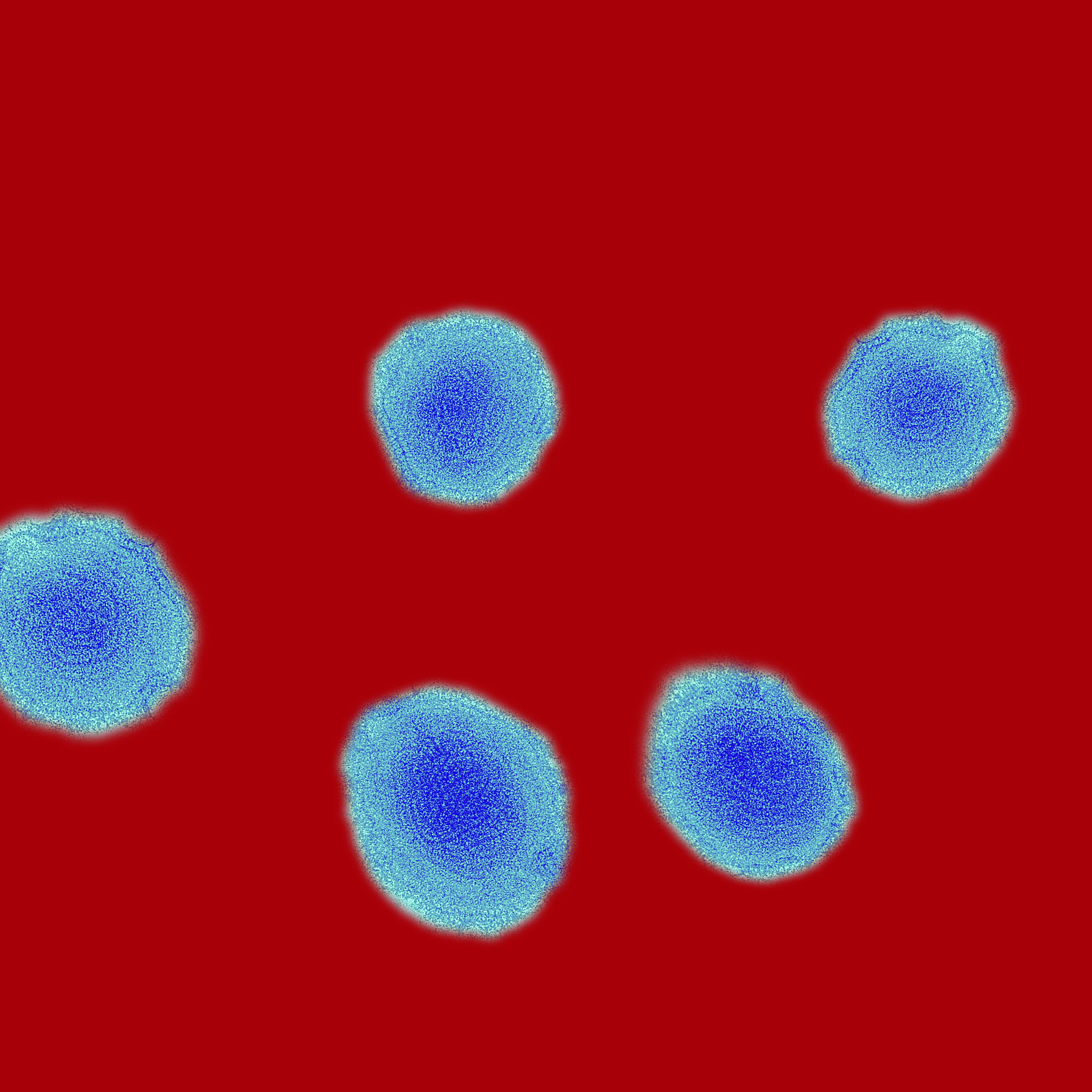 Not your friend: The measles virus—highly magnified—is exceedingly easy to transmit