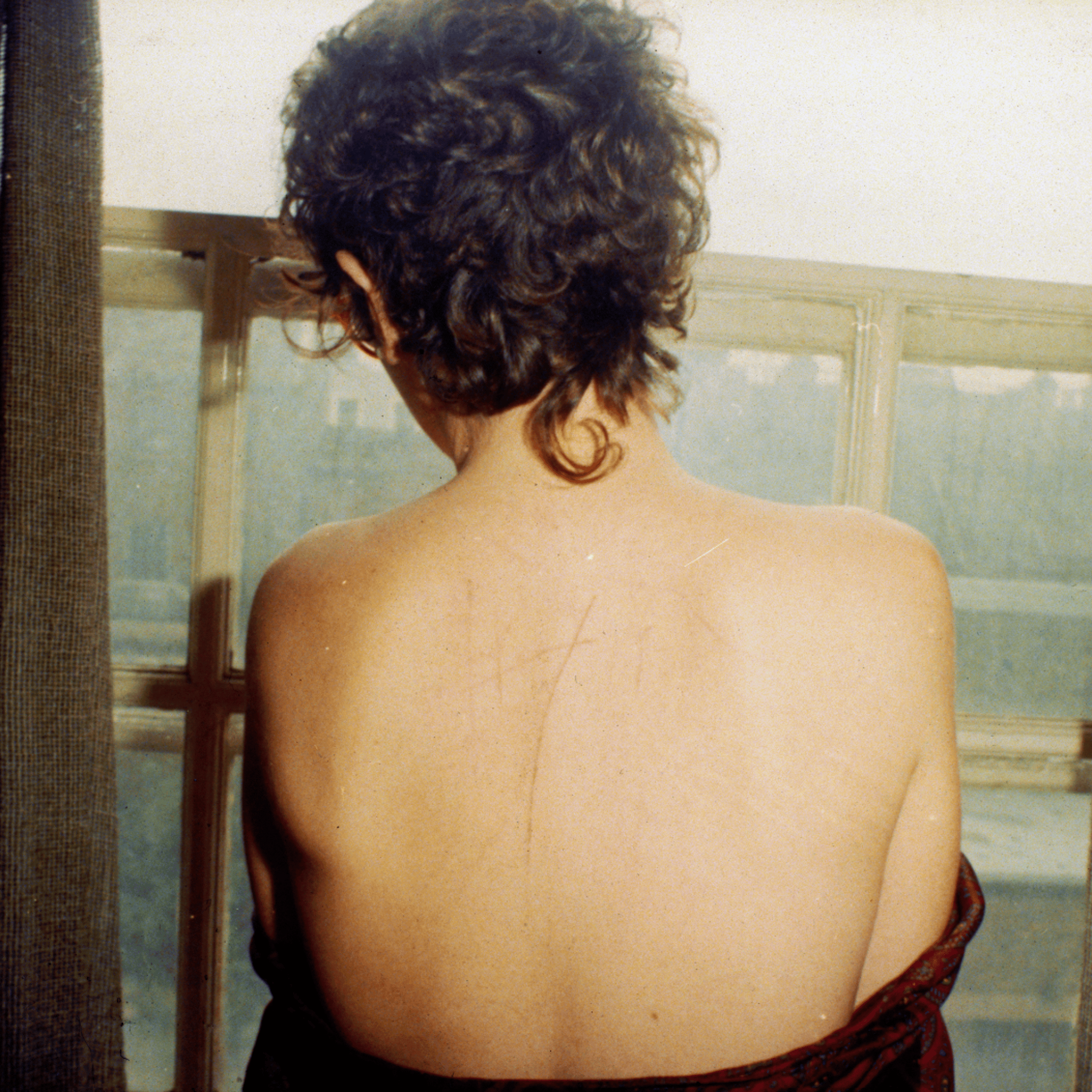 <i>Self portrait with scratched back after sex</i>