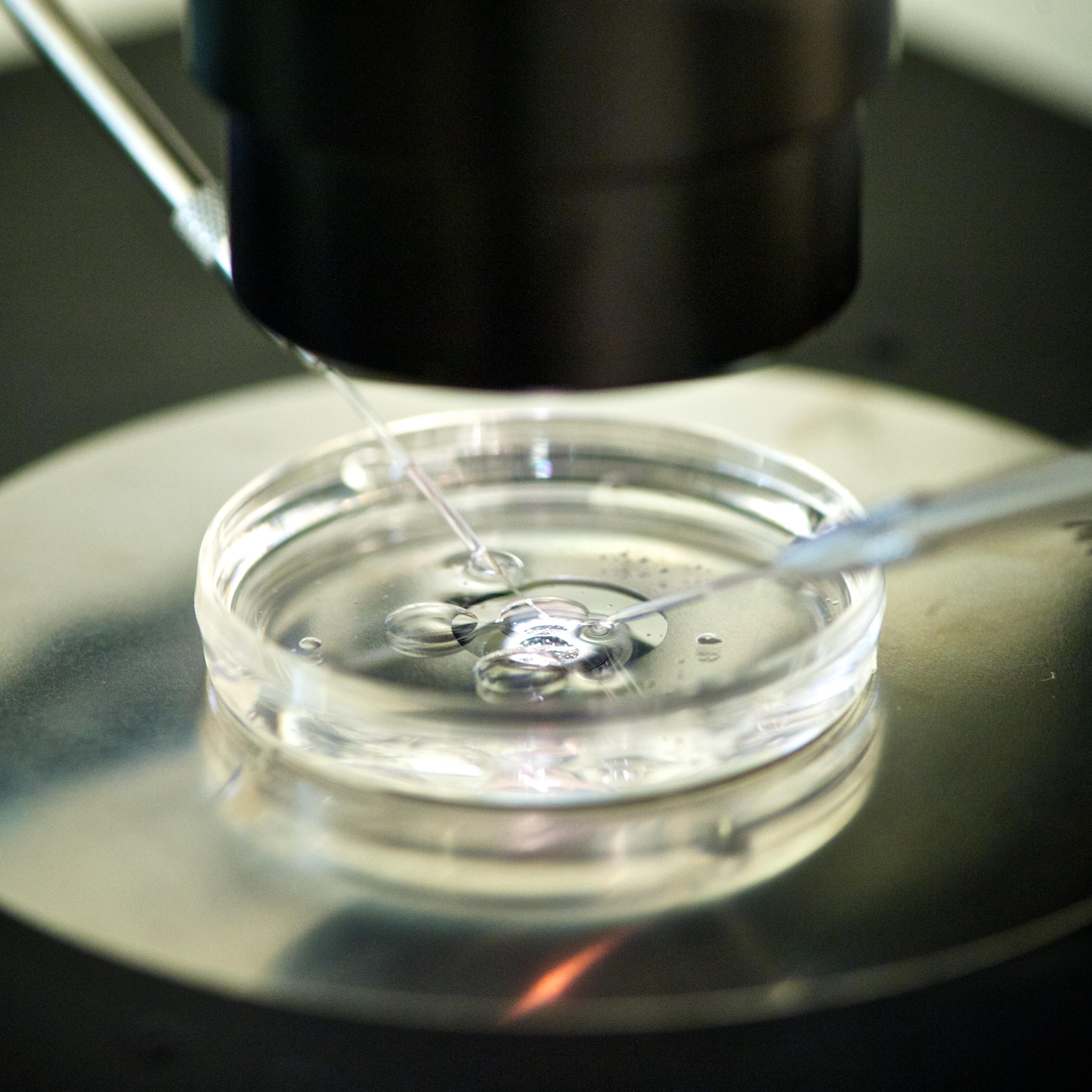 An in-vitro-fertilization in progress