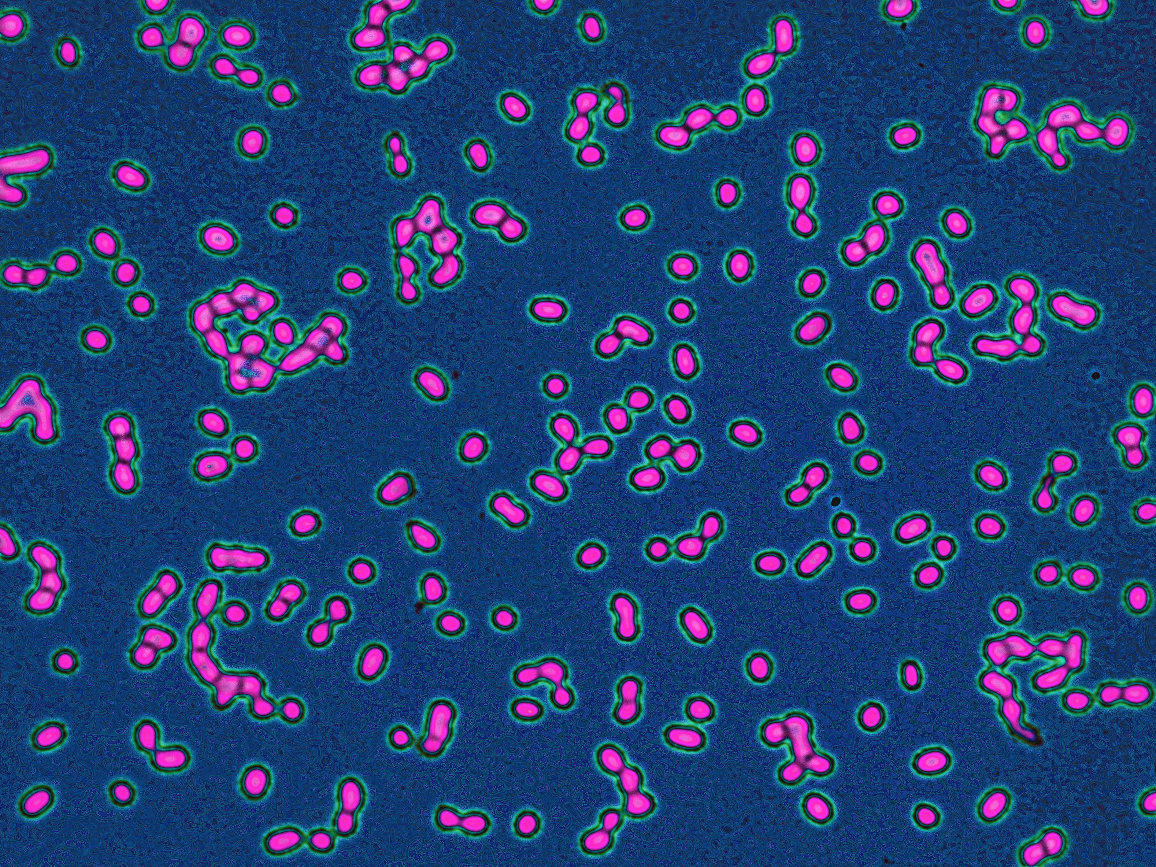Friedländer's pneumobacillus (Friedländer's bacillus), Klebsiella pneumoniae. This bacterium is the cause of some respiratory diseases in the lungs and particularly in the bronchial tubes. It is also the cause of throat infections, as well as infections 