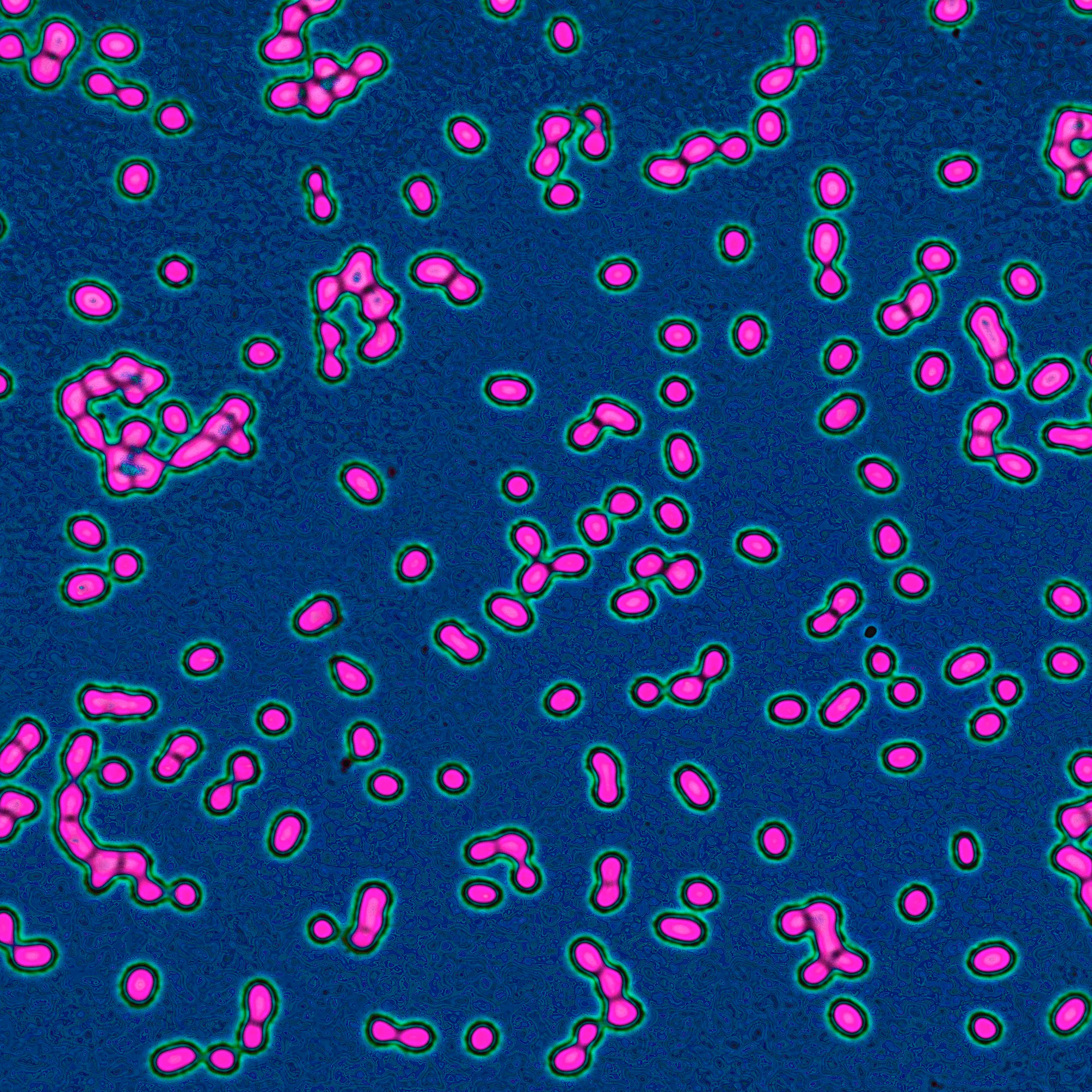 Friedländer's pneumobacillus (Friedländer's bacillus), Klebsiella pneumoniae. This bacterium is the cause of some respiratory diseases in the lungs and particularly in the bronchial tubes. It is also the cause of throat infections, as well as infections